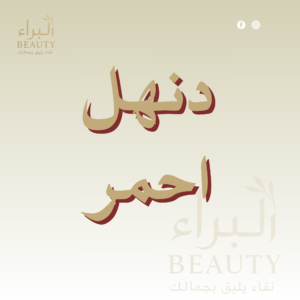دنهل أحمر